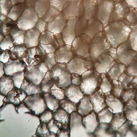 Celluledelsugherosezione trasversale Celluledelsugherosezione trasversale